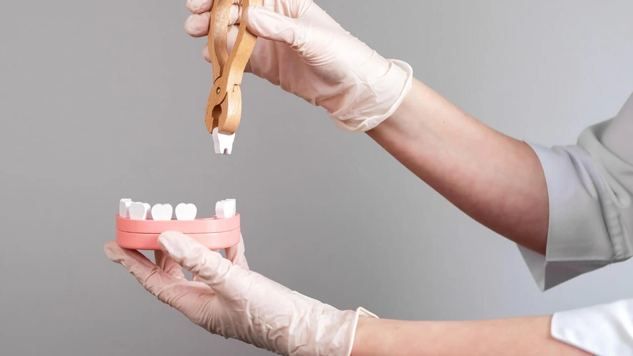 Tooth Extraction treatment at Tooth Buddy Dental Clinic