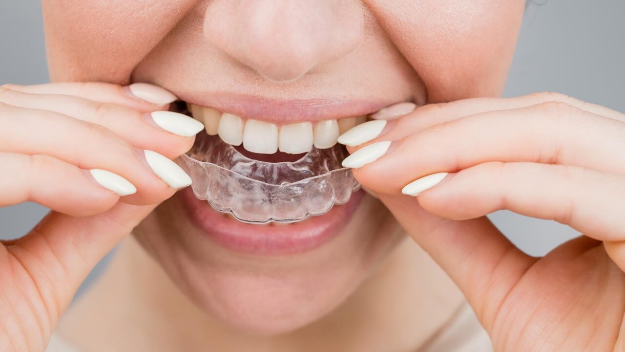 Invisalign treatment offers a discreet and effective way to straighten your teeth using custom clear aligners that fit seamlessly into your lifestyle.