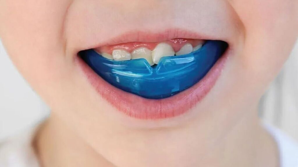 Tooth Buddy offers Myobrace therapy to help children develop proper jaw growth and oral habits naturally.